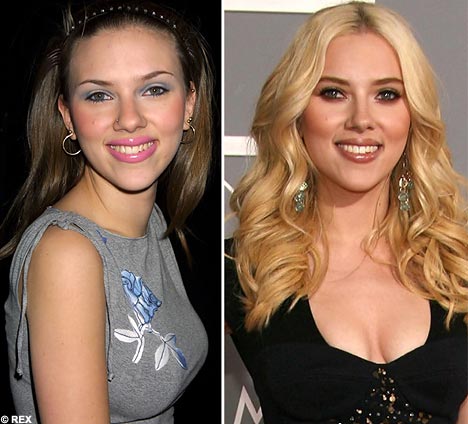 Has Scarlett Johansson Had Plastic Procedures Before And After Transformation Plasticsurgerypro Info