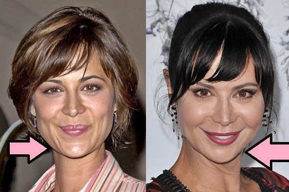 Catherine Bell Scar