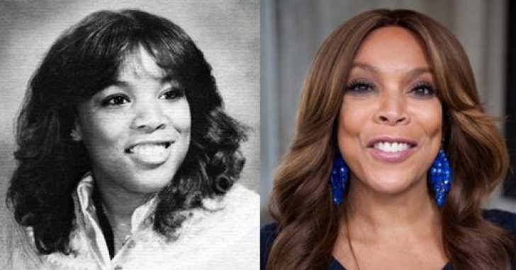 Wendy Williams Before And After Plastic Surgeries Plasticsurgerypro Info