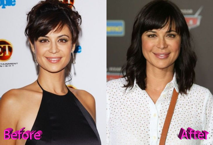 Catherine Bell’s plastic surgery