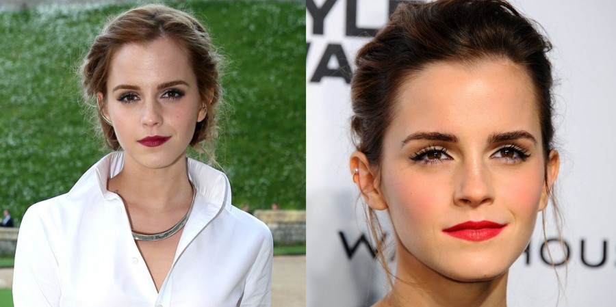 Emma Watson Breast Nose And Teeth Implant Before And After.