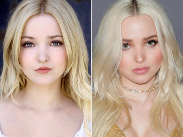 Dove Cameron's before and after photos