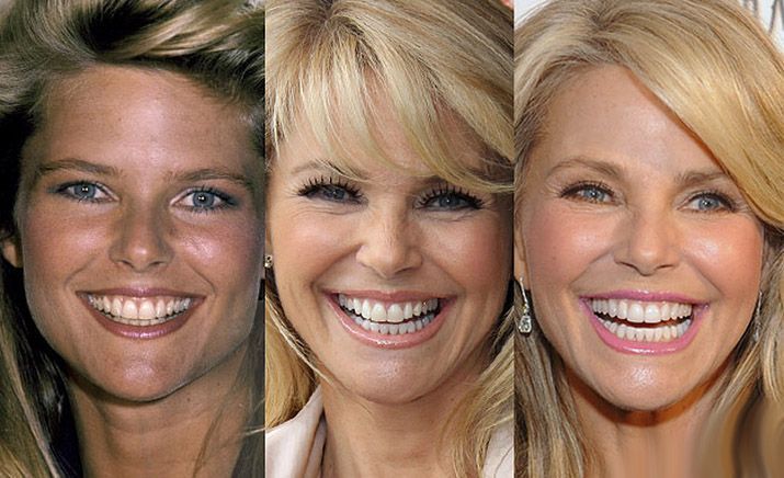 An image of Christie Brinkley