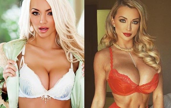 Lindsey Pelas Plastic Surgery Before and After Photos