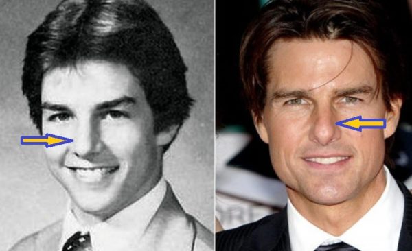 tom cruise crooked nose